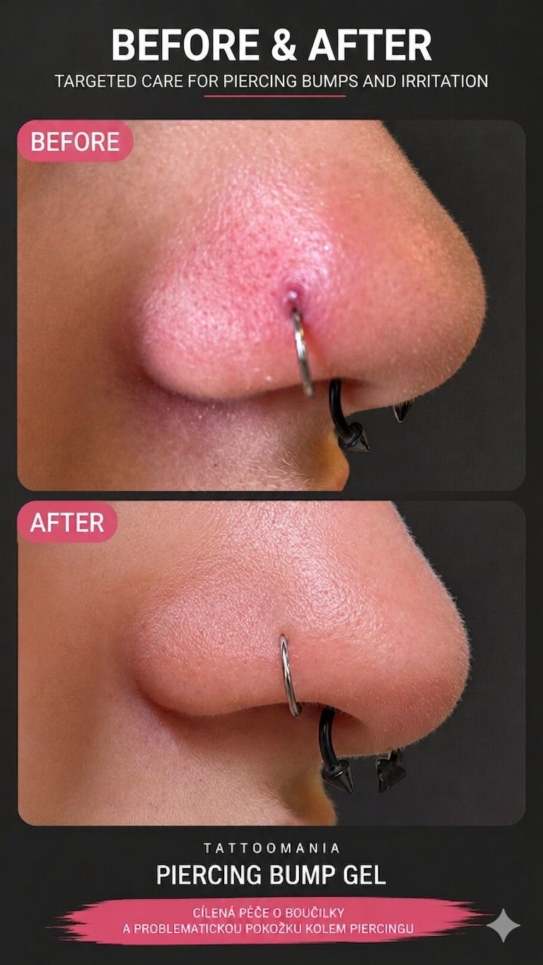 Boulička u piercingu nosu — před a po péči