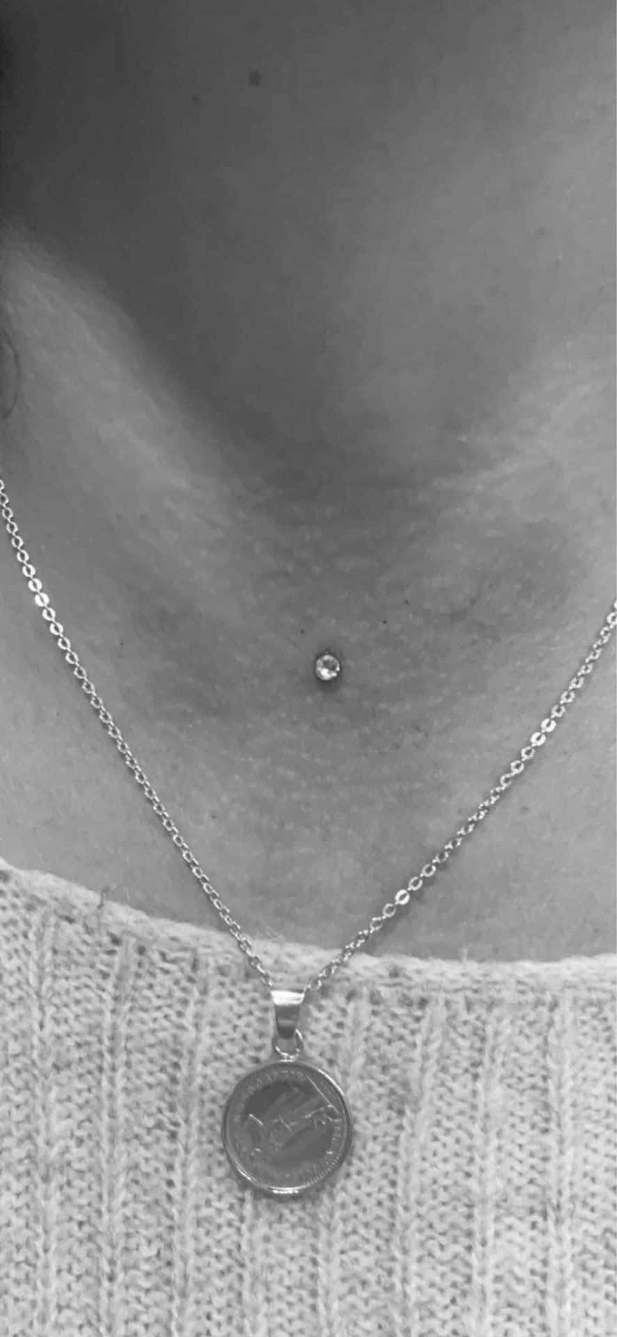 Microdermal