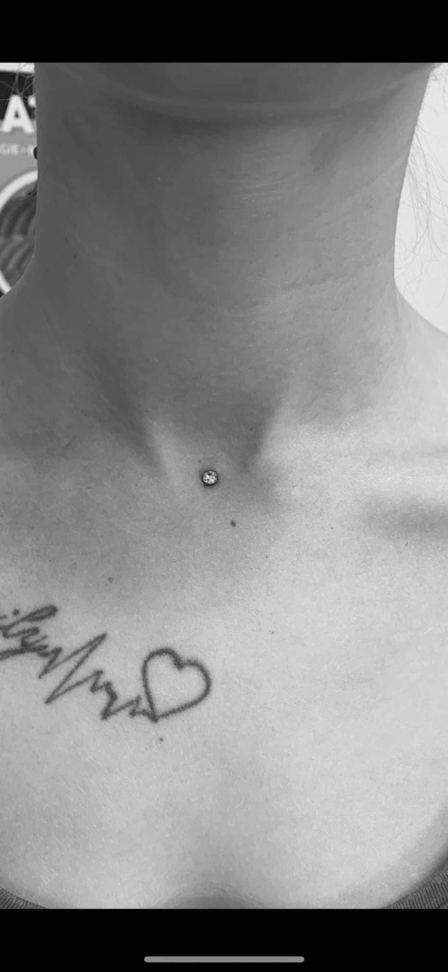 Microdermal na hrudi